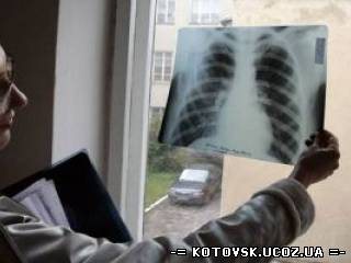 Количество заболевших туберкулезом на севере Одесской области увеличивается