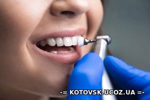 Что значит чистка зубов?